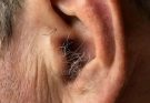 DID YOU KNOW⚠️that if hair grows on your ears, it’s because your body is…. Read more